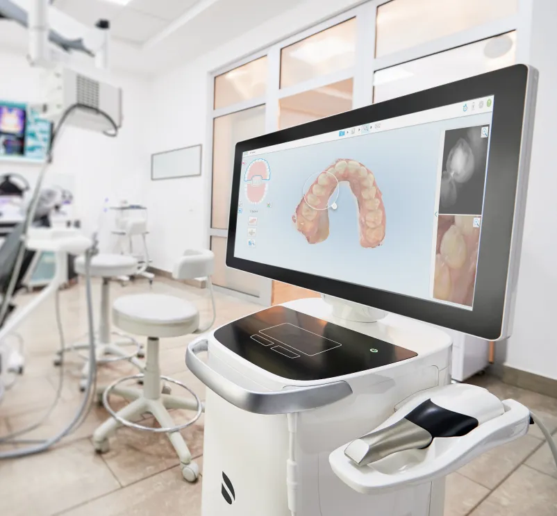 itero scanner